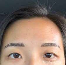 how long does microblading last